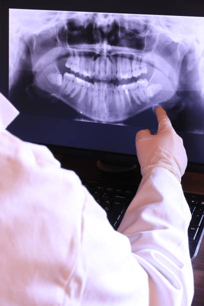 Dentist for Dental Trauma in IA