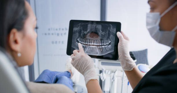 Teeth Whitening in IA